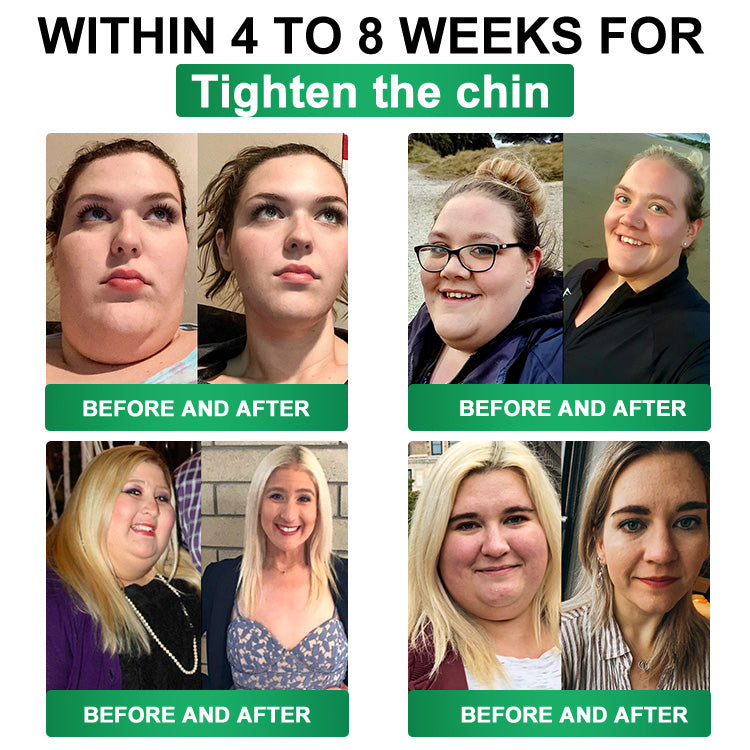 Limited to 10 boxes 🌟 careuplift®—Exclusive 30% discount, achieve your weight loss goals! A rare opportunity — won't be available again until next year, don’t miss out! 180-day money-back guarantee, full refund with no risk!