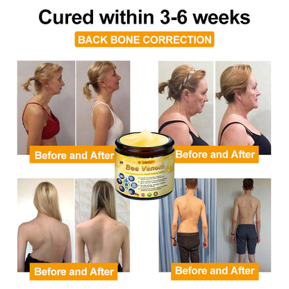 SIWOO® Bee Venom Anti-Swelling Pain Relief Healing Cream