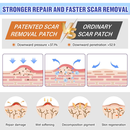Icystar®Tranexamic Acid silicone scar sheets