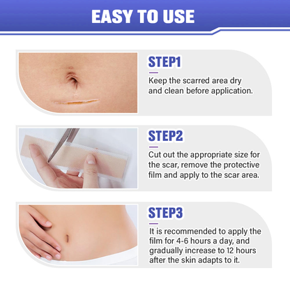 Icystar®Tranexamic Acid silicone scar sheets