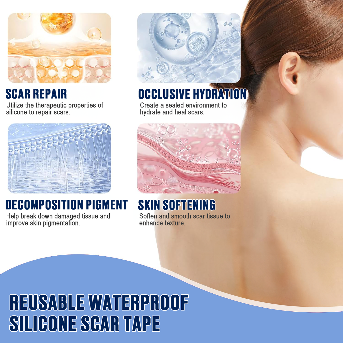 Icystar®Tranexamic Acid silicone scar sheets